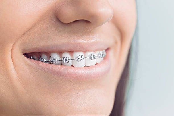 Best Dental X-Rays and Imaging  in Vermillion, SD
